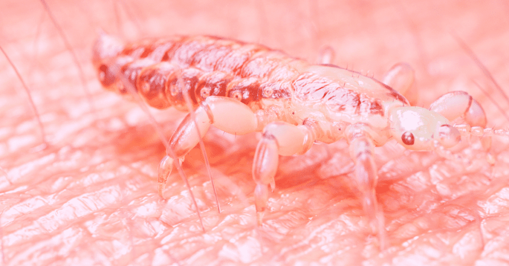 Body Lice feeding on a human hand