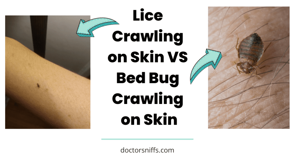 Bed Bug crawling on skin vs a louse on skin