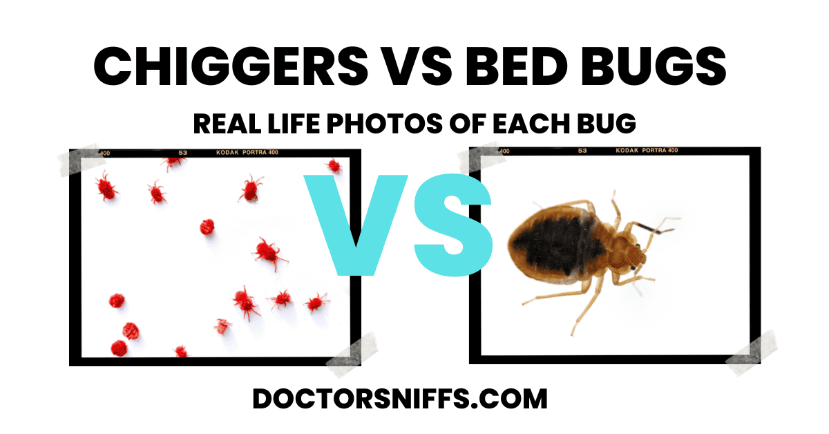 Chiggers in Bed Here's What You Need to Know