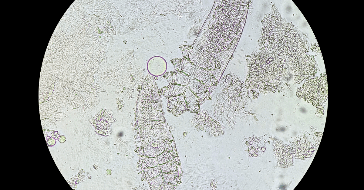 10 Examples of Mites That Bite Humans and Pets