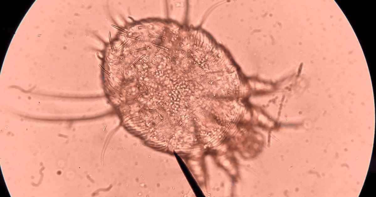 10 Examples of Mites That Bite Humans and Pets