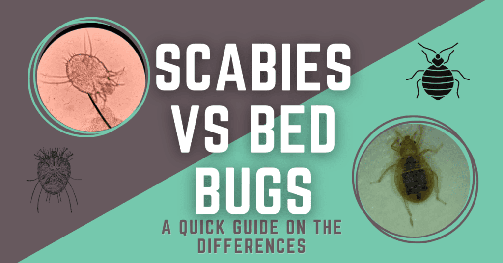 Scabies vs Bed Bugs Quick Guide to Spot the Differences